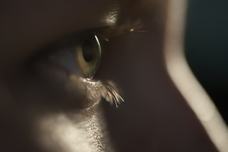 retinosis-pigmentaria-rp-baja-vision-sevilla.png