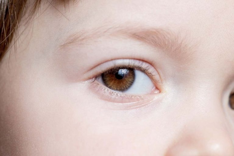 sindrome-de-usher.jpg